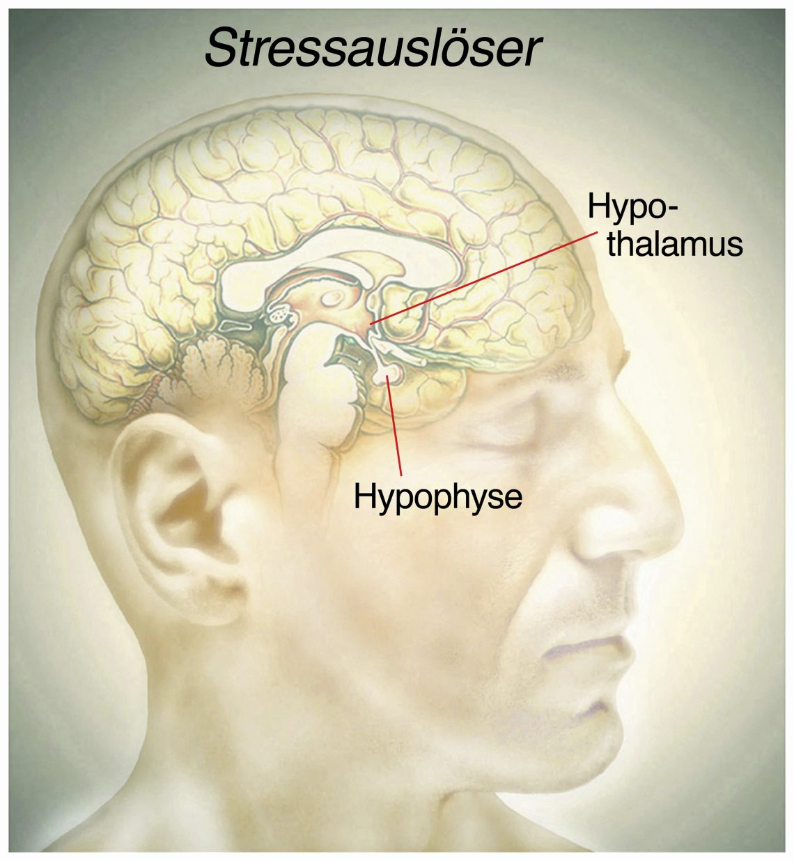 Stress wird durch falsche Gedanken im Gehirn ausgelöst