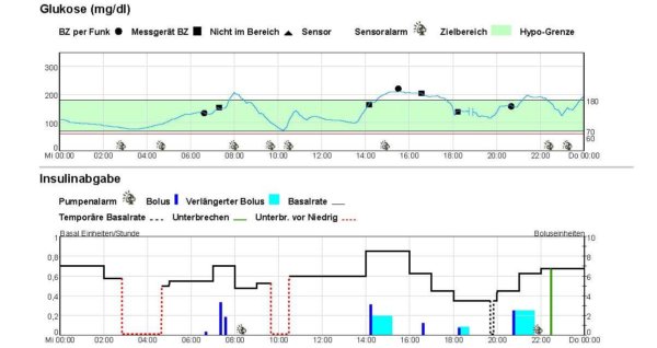 CGM-Kurve_Katrin