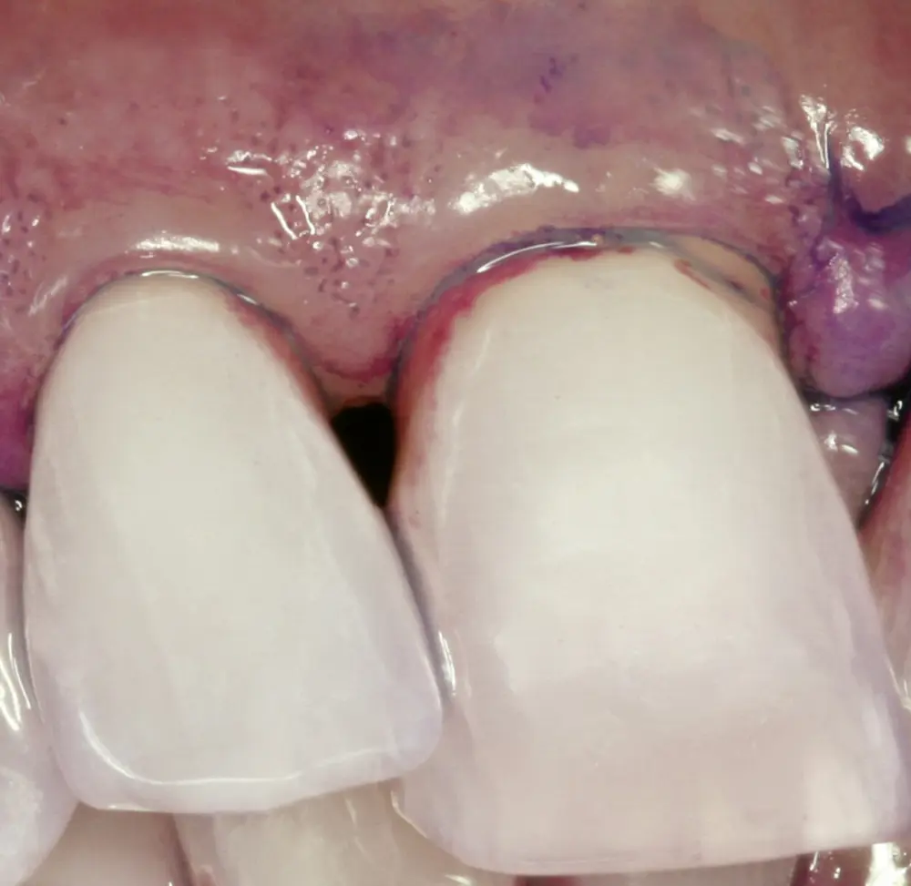 Foto:  Prof. Dr. med. dent. Peter Eickholz 