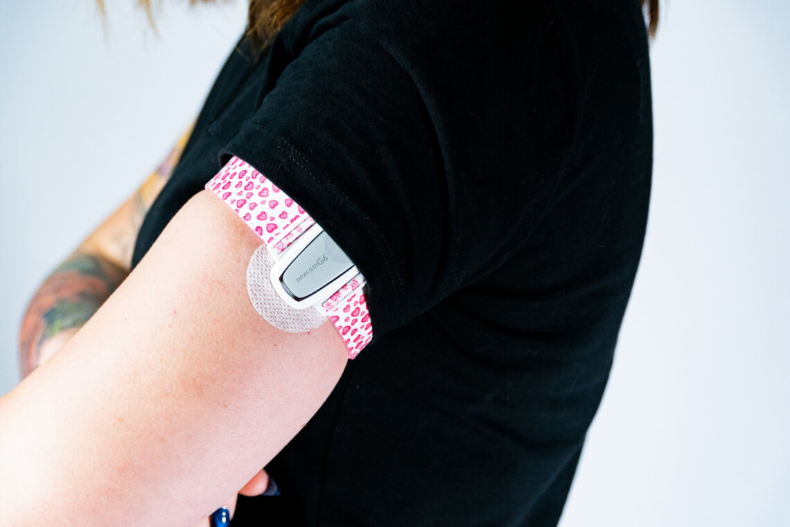 Der Dexcom G6 mit Armgurt