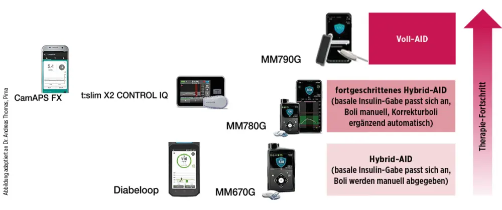 Übersicht zur Entwicklung von Hybrid-Closed-Loop- und AID-Systemen. Beispiele sind CamAPS FX, t:slim X2 Control-IQ, Diabeloop sowie die Medtronic-Systeme MiniMed 670G, 780G und 790G. Eine vertikale Skala zeigt den Therapiefortschritt vom Hybrid-AID über das fortgeschrittene Hybrid-AID bis zum Voll-AID. Beim Hybrid-AID wird die basale Insulinabgabe automatisch angepasst, während Boli manuell abgegeben werden.