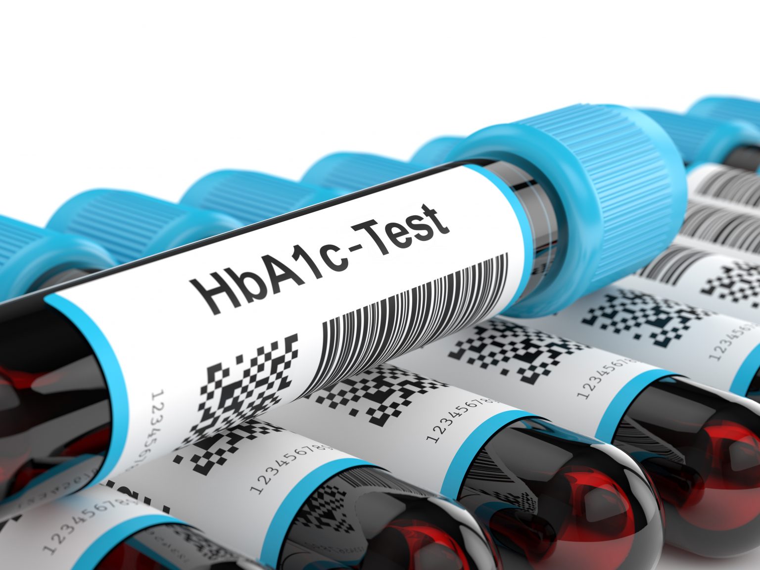 Langzeit-Blutzuckerwert HbA1c: Welcher Zielwert passt zu meinem Leben?