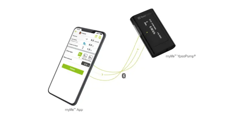 Schematische Darstellung der Kommunukation zwischen der Smartphone-App und der mylife Ypsopump.