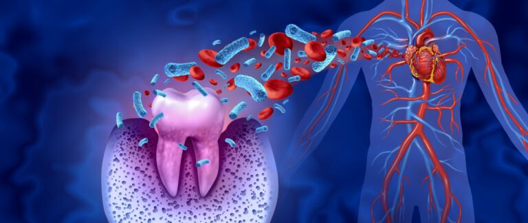 Diabetes und Parodontitis – neues Projekt soll Früherkennung und Versorgung verbessern