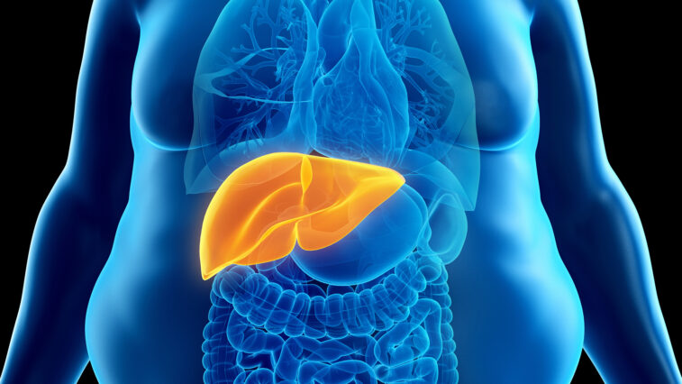 Die Subtypen der Fettleber: Neue Erkenntnisse zu Ursachen und Therapie | Foto: Sebastian Kaulitzki – stock.adobe.com