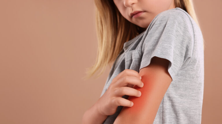 Serie „HAUT-Sache Typ-1-Diabetes“ – Teil 1: Diabetes-Technologie kann die Haut verändern | Foto: New Africa – stock.adobe.com