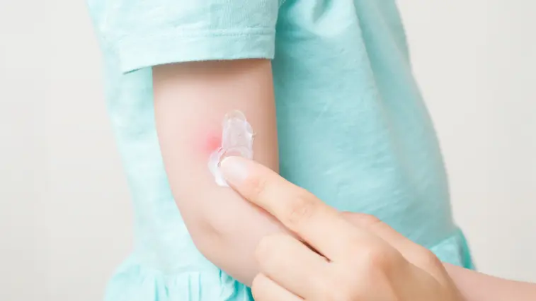 Serie „HAUT-Sache Typ-1-Diabetes“ – Teil 2: Die Haut richtig pflegen und schützen | Foto: fotoduets – stock.adobe.com