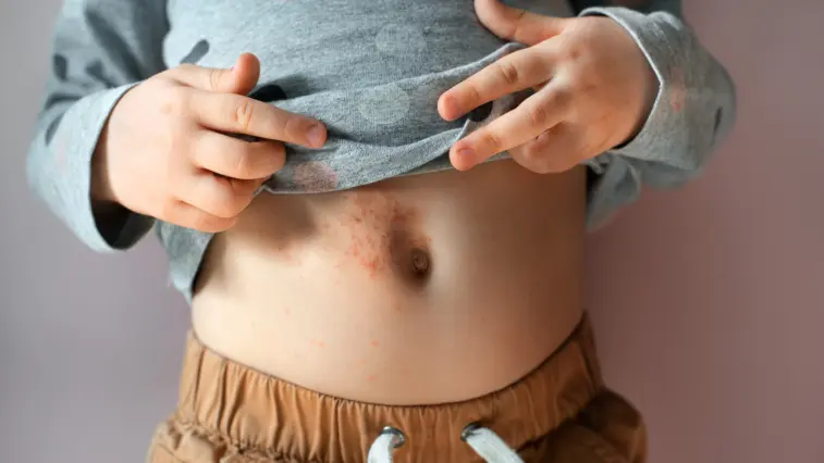 „HAUT-Sache Typ-1-Diabetes“ – Teil 3: Was tun, wenn Haut-Veränderungen auftreten? | Foto: shangarey – stock.adobe.com