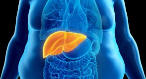 Die Subtypen der Fettleber: Neue Erkenntnisse zu Ursachen und Therapie | Foto: Sebastian Kaulitzki – stock.adobe.com