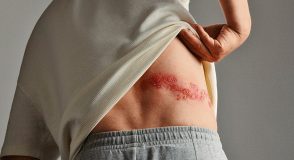 Jeder Dritte erkrankt an Gürtelrose: Vorsorge für Ältere und chronisch Kranke besonders wichtig | Foto: Publicis China / Publicis UK – ASSET-242627