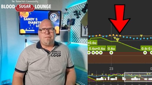 Video: Wieso erreichen wir beim Loopen oftmals keine bessere Time in Range (TIR)? | Foto: privat