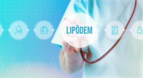 Nachgefragt | Recht: Wann übernimmt die Krankenkasse die Kosten für eine Lipödem-Behandlung? | Foto: MQ-Illustrations – stock.adobe.com